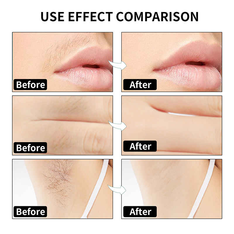 ⚡2025 Hot Sale 50% OFF 🔥90PCS Body Hair Removal Wax Strips