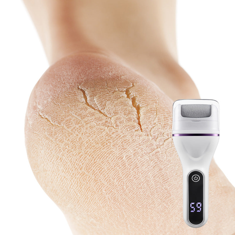 🔥2025 Hot Sale🔥Portable Electric Foot Callus Remover