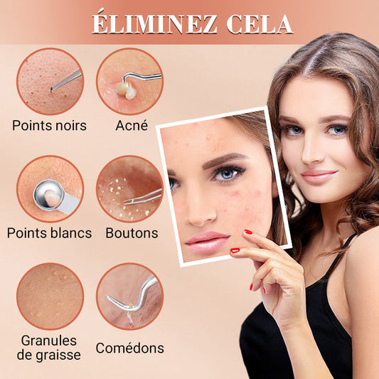💓 50% discount 💥 Blackhead and Button Extraction Toolkit
