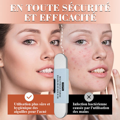 💓 50% discount 💥 Blackhead and Button Extraction Toolkit