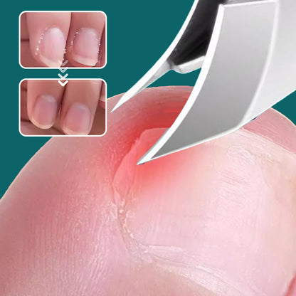 🔥Limited SALE 49% OFF🎁 Anti-Splash 25° Slant Edge Nail Clipper 3-Piece Set