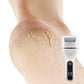 🔥2025 Hot Sale🔥Portable Electric Foot Callus Remover