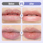 🏆Flash Sale⚡30K+ SOLD!Plumping & Anti-Wrinkle Hydrating Lip Serum